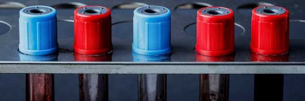 Как выбрать качественную катушку: советы по проверке и покупке